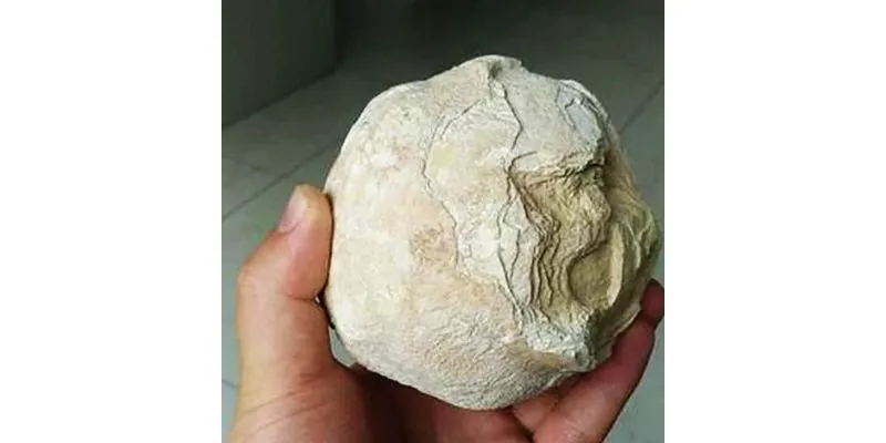 Đi tiểu ra máu 